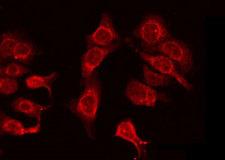 OR4N4 Antibody - Staining HeLa cells by IF/ICC. The samples were fixed with PFA and permeabilized in 0.1% Triton X-100, then blocked in 10% serum for 45 min at 25°C. The primary antibody was diluted at 1:200 and incubated with the sample for 1 hour at 37°C. An Alexa Fluor 594 conjugated goat anti-rabbit IgG (H+L) Ab, diluted at 1/600, was used as the secondary antibody.