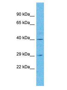 OR4N5 Antibody - OR4N5 antibody Western Blot of Jurkat. Antibody dilution: 1 ug/ml.  This image was taken for the unconjugated form of this product. Other forms have not been tested.