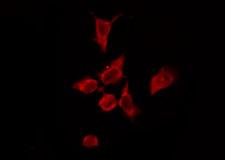 OR4P4 Antibody - Staining HeLa cells by IF/ICC. The samples were fixed with PFA and permeabilized in 0.1% Triton X-100, then blocked in 10% serum for 45 min at 25°C. The primary antibody was diluted at 1:200 and incubated with the sample for 1 hour at 37°C. An Alexa Fluor 594 conjugated goat anti-rabbit IgG (H+L) Ab, diluted at 1/600, was used as the secondary antibody.