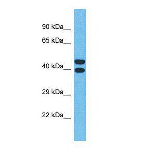 OR4Q3 Antibody - Western blot of Human MCF7. OR4Q3 antibody dilution 1.0 ug/ml.  This image was taken for the unconjugated form of this product. Other forms have not been tested.
