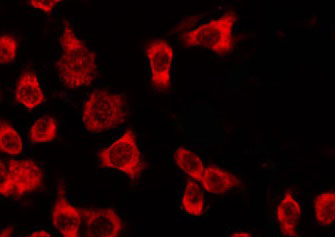 OR4Q3 Antibody - Staining HeLa cells by IF/ICC. The samples were fixed with PFA and permeabilized in 0.1% Triton X-100, then blocked in 10% serum for 45 min at 25°C. The primary antibody was diluted at 1:200 and incubated with the sample for 1 hour at 37°C. An Alexa Fluor 594 conjugated goat anti-rabbit IgG (H+L) Ab, diluted at 1/600, was used as the secondary antibody.