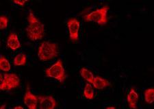 OR4Q3 Antibody - Staining HeLa cells by IF/ICC. The samples were fixed with PFA and permeabilized in 0.1% Triton X-100, then blocked in 10% serum for 45 min at 25°C. The primary antibody was diluted at 1:200 and incubated with the sample for 1 hour at 37°C. An Alexa Fluor 594 conjugated goat anti-rabbit IgG (H+L) Ab, diluted at 1/600, was used as the secondary antibody.