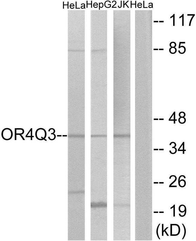 OR4Q3 Antibody - Western blot analysis of extracts from HeLa cells, HepG2 cells and Jurkat cells, using OR4Q3 antibody.