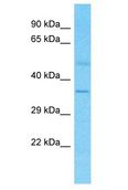 OR4S1 Antibody - OR4S1 antibody Western Blot of Fetal Kidney. Antibody dilution: 1 ug/ml.  This image was taken for the unconjugated form of this product. Other forms have not been tested.