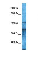 OR4S2 Antibody - Western blot of Human OVCAR-3. OR4S2 antibody dilution 1.0 ug/ml.  This image was taken for the unconjugated form of this product. Other forms have not been tested.