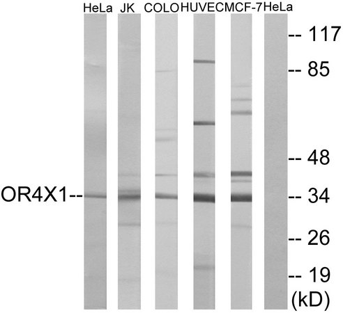 OR4X1 Antibody - Western blot analysis of lysates from HeLa, Jurkat, HUVEC, MCF-7, and COLO cells, using OR4X1 Antibody. The lane on the right is blocked with the synthesized peptide.