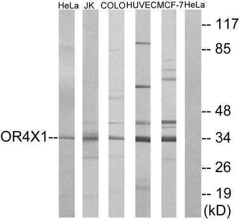 OR4X1 Antibody - Western blot analysis of extracts from HeLa cells, Jurkat cells, COLO cells, HUVEC cells and MCF-7 cells, using OR4X1 antibody.