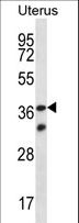 OR4X2 Antibody - OR4X2 Antibody western blot of human normal Uterus tissue lysates (35 ug/lane). The OR4X2 antibody detected the OR4X2 protein (arrow).