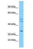 OR4X2 Antibody - OR4X2 antibody Western Blot of HepG2. Antibody dilution: 1 ug/ml.  This image was taken for the unconjugated form of this product. Other forms have not been tested.