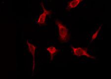 OR51A2 Antibody - Staining HeLa cells by IF/ICC. The samples were fixed with PFA and permeabilized in 0.1% Triton X-100, then blocked in 10% serum for 45 min at 25°C. The primary antibody was diluted at 1:200 and incubated with the sample for 1 hour at 37°C. An Alexa Fluor 594 conjugated goat anti-rabbit IgG (H+L) Ab, diluted at 1/600, was used as the secondary antibody.