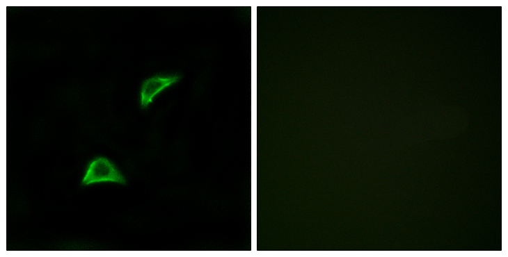 OR51A4 Antibody - Immunofluorescence analysis of LOVO cells, using OR51A4 Antibody. The picture on the right is blocked with the synthesized peptide.