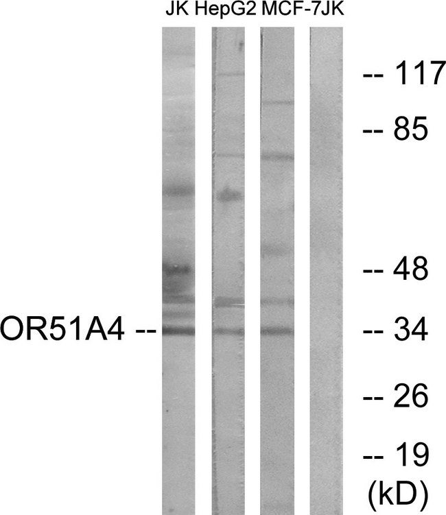 OR51A4 Antibody - Western blot analysis of lysates from Jurkat, HepG2, and MCF-7 cells, using OR51A4 Antibody. The lane on the right is blocked with the synthesized peptide.
