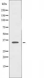 OR51A4 Antibody - Western blot analysis of extracts of Jurkat cells using OR51A4 antibody.