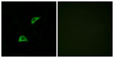 OR51A4 Antibody - Peptide - + Immunofluorescence analysis of LOVO cells, using OR51A4 antibody.