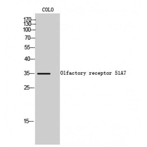 OR51A7 Antibody - Western blot of Olfactory receptor 51A7 antibody