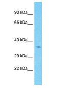 OR51A7 Antibody - OR51A7 antibody Western Blot of HCT15. Antibody dilution: 1 ug/ml.  This image was taken for the unconjugated form of this product. Other forms have not been tested.