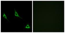 OR51A7 Antibody - Immunofluorescence analysis of LOVO cells, using OR51A7 Antibody. The picture on the right is blocked with the synthesized peptide.