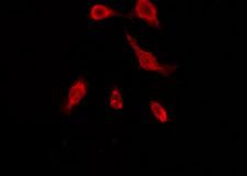 OR51A7 Antibody - Staining COLO205 cells by IF/ICC. The samples were fixed with PFA and permeabilized in 0.1% Triton X-100, then blocked in 10% serum for 45 min at 25°C. The primary antibody was diluted at 1:200 and incubated with the sample for 1 hour at 37°C. An Alexa Fluor 594 conjugated goat anti-rabbit IgG (H+L) Ab, diluted at 1/600, was used as the secondary antibody.