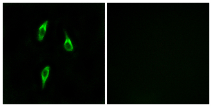 OR51B2 Antibody - Immunofluorescence analysis of LOVO cells, using OR51B2 Antibody. The picture on the right is blocked with the synthesized peptide.
