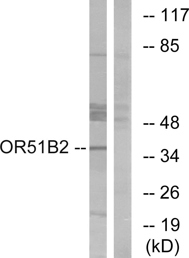 OR51B2 Antibody - Western blot analysis of lysates from HT-29 cells, using OR51B2 Antibody. The lane on the right is blocked with the synthesized peptide.