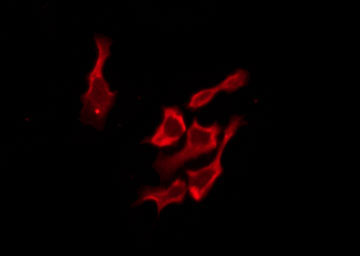 OR51B2 Antibody - Staining HT29 cells by IF/ICC. The samples were fixed with PFA and permeabilized in 0.1% Triton X-100, then blocked in 10% serum for 45 min at 25°C. The primary antibody was diluted at 1:200 and incubated with the sample for 1 hour at 37°C. An Alexa Fluor 594 conjugated goat anti-rabbit IgG (H+L) Ab, diluted at 1/600, was used as the secondary antibody.