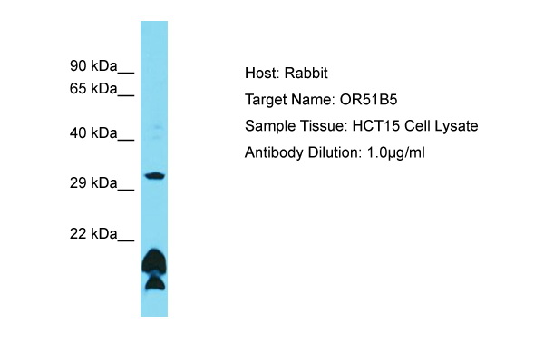 OR51B5 Antibody -  This image was taken for the unconjugated form of this product. Other forms have not been tested.