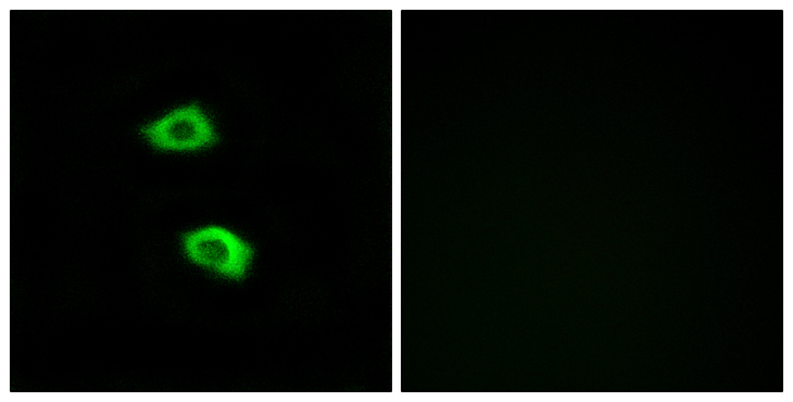 OR51B5 Antibody - Immunofluorescence analysis of LOVO cells, using OR51B5 Antibody. The picture on the right is blocked with the synthesized peptide.