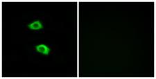 OR51B5 Antibody - Immunofluorescence analysis of LOVO cells, using OR51B5 Antibody. The picture on the right is blocked with the synthesized peptide.