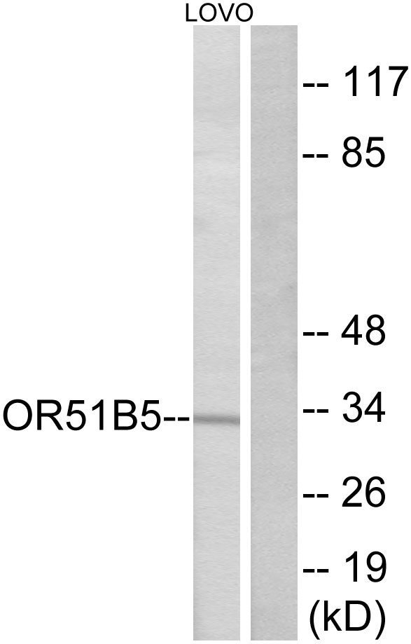 OR51B5 Antibody - Western blot analysis of lysates from LOVO cells, using OR51B5 Antibody. The lane on the right is blocked with the synthesized peptide.