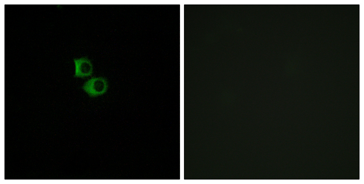 OR51B6 Antibody - Immunofluorescence analysis of MCF7 cells, using OR51B6 Antibody. The picture on the right is blocked with the synthesized peptide.