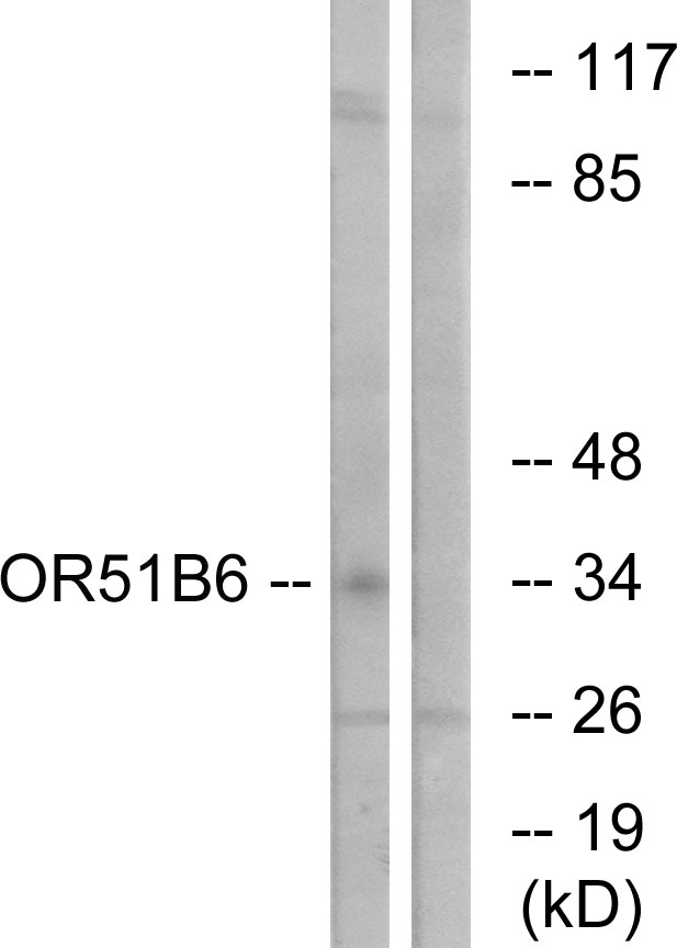 OR51B6 Antibody - Western blot analysis of lysates from K562 cells, using OR51B6 Antibody. The lane on the right is blocked with the synthesized peptide.