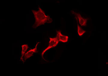 OR51B6 Antibody - Staining HeLa cells by IF/ICC. The samples were fixed with PFA and permeabilized in 0.1% Triton X-100, then blocked in 10% serum for 45 min at 25°C. The primary antibody was diluted at 1:200 and incubated with the sample for 1 hour at 37°C. An Alexa Fluor 594 conjugated goat anti-rabbit IgG (H+L) Ab, diluted at 1/600, was used as the secondary antibody.