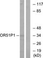 OR51D1 Antibody - Western blot analysis of lysates from Jurkat cells, using OR51D1 Antibody. The lane on the right is blocked with the synthesized peptide.