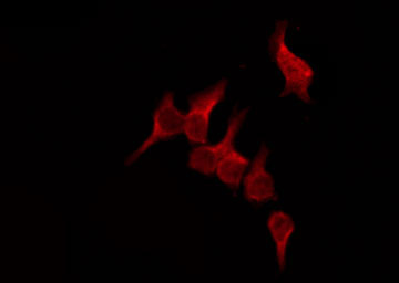 OR51D1 Antibody - Staining HeLa cells by IF/ICC. The samples were fixed with PFA and permeabilized in 0.1% Triton X-100, then blocked in 10% serum for 45 min at 25°C. The primary antibody was diluted at 1:200 and incubated with the sample for 1 hour at 37°C. An Alexa Fluor 594 conjugated goat anti-rabbit IgG (H+L) Ab, diluted at 1/600, was used as the secondary antibody.