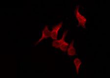 OR51D1 Antibody - Staining HeLa cells by IF/ICC. The samples were fixed with PFA and permeabilized in 0.1% Triton X-100, then blocked in 10% serum for 45 min at 25°C. The primary antibody was diluted at 1:200 and incubated with the sample for 1 hour at 37°C. An Alexa Fluor 594 conjugated goat anti-rabbit IgG (H+L) Ab, diluted at 1/600, was used as the secondary antibody.