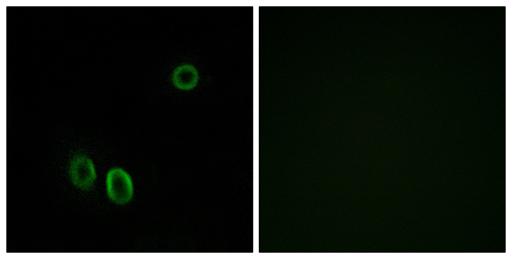 OR51E1 Antibody - Immunofluorescence analysis of A549 cells, using OR51E1 Antibody. The picture on the right is blocked with the synthesized peptide.