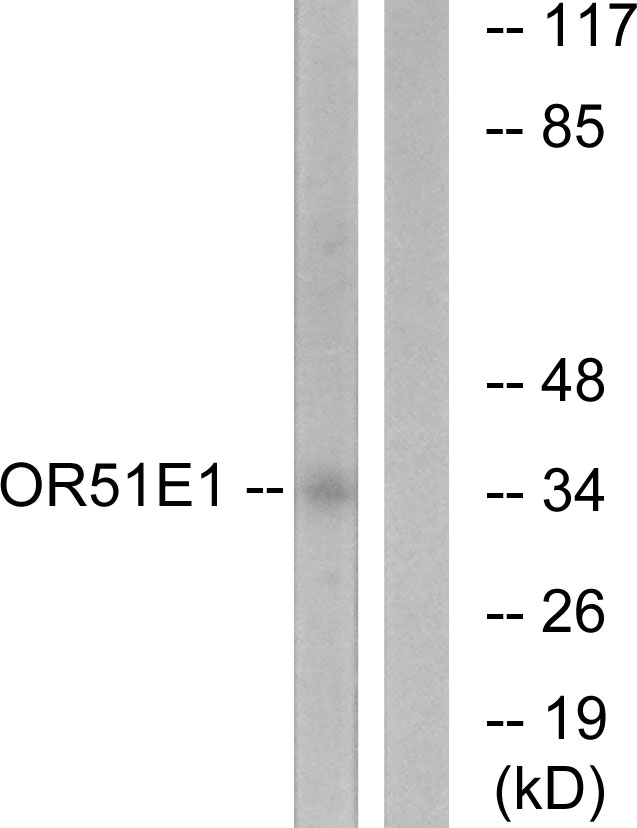OR51E1 Antibody - Western blot analysis of lysates from HeLa cells, using OR51E1 Antibody. The lane on the right is blocked with the synthesized peptide.