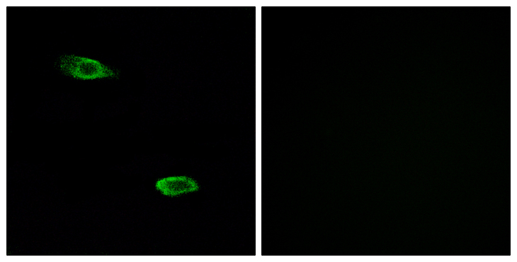 OR51E2 / PSGR Antibody - Immunofluorescence analysis of A549 cells, using OR51E2 Antibody. The picture on the right is blocked with the synthesized peptide.