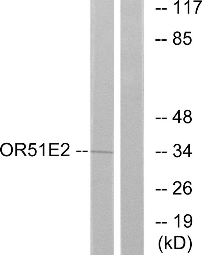 OR51E2 / PSGR Antibody - Western blot analysis of lysates from Jurkat cells, using OR51E2 Antibody. The lane on the right is blocked with the synthesized peptide.