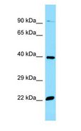 OR51E2 / PSGR Antibody - OR51E2 / PSGR antibody Western Blot of HepG2.  This image was taken for the unconjugated form of this product. Other forms have not been tested.