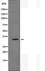 OR51E2 / PSGR Antibody - Western blot analysis of OR51E2 antibody expression in JK cells lysates.