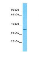 OR51F2 Antibody - Western blot of Human Fetal Lung. OR51F2 antibody dilution 1.0 ug/ml.  This image was taken for the unconjugated form of this product. Other forms have not been tested.
