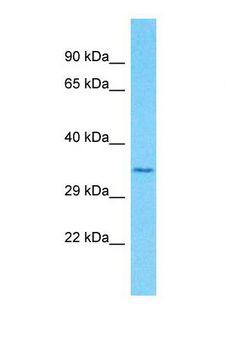 OR51F2 Antibody - Western blot of Human Fetal Lung. OR51F2 antibody dilution 1.0 ug/ml.  This image was taken for the unconjugated form of this product. Other forms have not been tested.