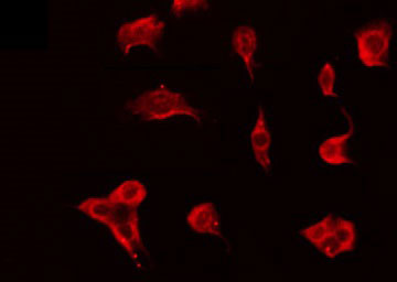 OR51F2 Antibody - Staining HeLa cells by IF/ICC. The samples were fixed with PFA and permeabilized in 0.1% Triton X-100, then blocked in 10% serum for 45 min at 25°C. The primary antibody was diluted at 1:200 and incubated with the sample for 1 hour at 37°C. An Alexa Fluor 594 conjugated goat anti-rabbit IgG (H+L) Ab, diluted at 1/600, was used as the secondary antibody.