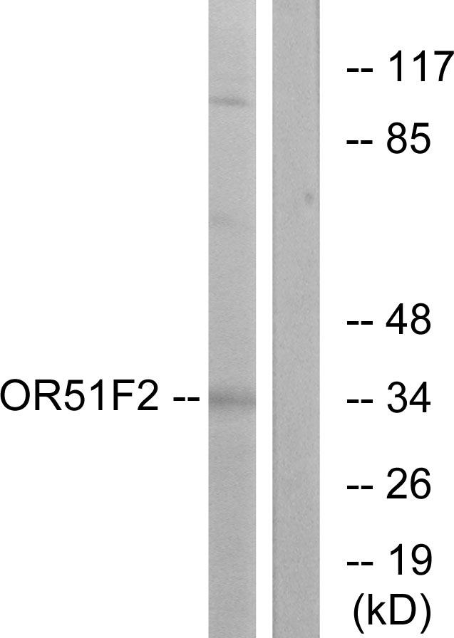 OR51F2 Antibody - Western blot analysis of extracts from K562 cells, using OR51F2 antibody.
