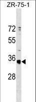 OR51G1 Antibody - OR51G1 Antibody western blot of ZR-75-1 cell line lysates (35 ug/lane). The OR51G1 Antibody detected the OR51G1 protein (arrow).
