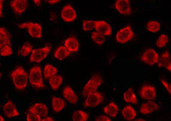 OR51G1 Antibody - Staining COLO205 cells by IF/ICC. The samples were fixed with PFA and permeabilized in 0.1% Triton X-100, then blocked in 10% serum for 45 min at 25°C. The primary antibody was diluted at 1:200 and incubated with the sample for 1 hour at 37°C. An Alexa Fluor 594 conjugated goat anti-rabbit IgG (H+L) Ab, diluted at 1/600, was used as the secondary antibody.