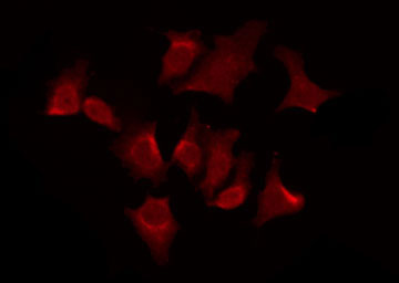 OR51G2 Antibody - Staining HeLa cells by IF/ICC. The samples were fixed with PFA and permeabilized in 0.1% Triton X-100, then blocked in 10% serum for 45 min at 25°C. The primary antibody was diluted at 1:200 and incubated with the sample for 1 hour at 37°C. An Alexa Fluor 594 conjugated goat anti-rabbit IgG (H+L) Ab, diluted at 1/600, was used as the secondary antibody.