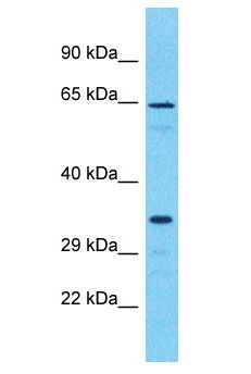OR51I2 Antibody - OR51I2 antibody Western Blot of THP-1. Antibody dilution: 1 ug/ml.  This image was taken for the unconjugated form of this product. Other forms have not been tested.