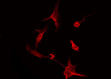 OR51I2 Antibody - Staining HuvEc cells by IF/ICC. The samples were fixed with PFA and permeabilized in 0.1% Triton X-100, then blocked in 10% serum for 45 min at 25°C. The primary antibody was diluted at 1:200 and incubated with the sample for 1 hour at 37°C. An Alexa Fluor 594 conjugated goat anti-rabbit IgG (H+L) Ab, diluted at 1/600, was used as the secondary antibody.